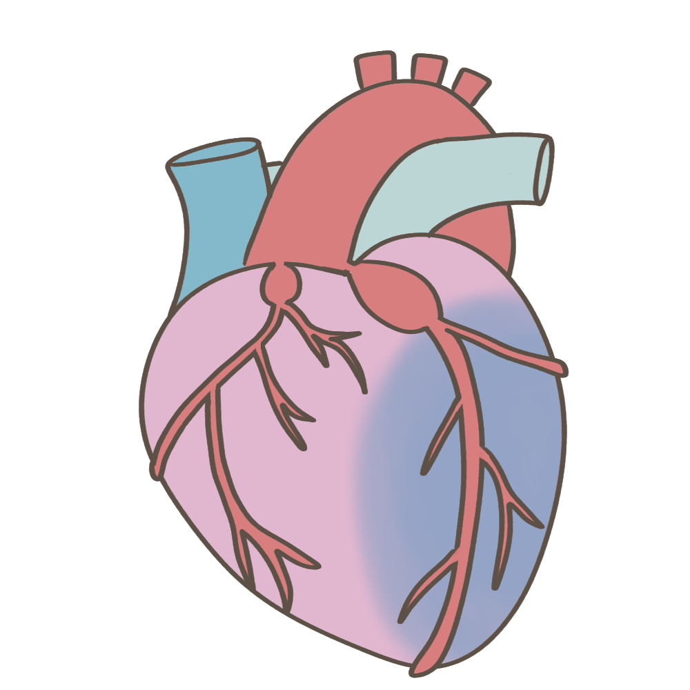 心筋梗塞のフリーイラスト素材