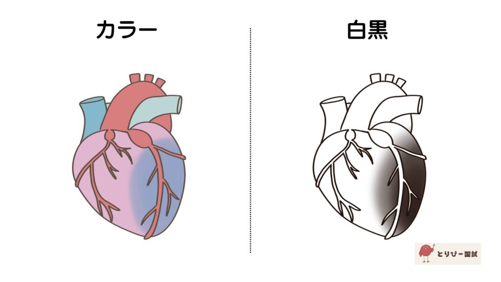 心筋梗塞のフリーイラスト素材（カラーと白黒プレビュー）
