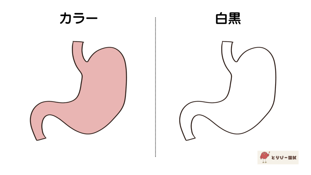 胃のイラスト、カラー比較