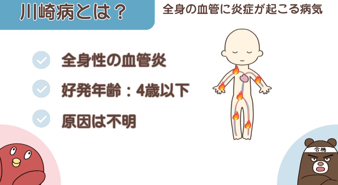 川崎病 血管炎 _ 川崎病 治療 – 川崎病血管炎と遠隔期血管リモデリングを考える – NSME