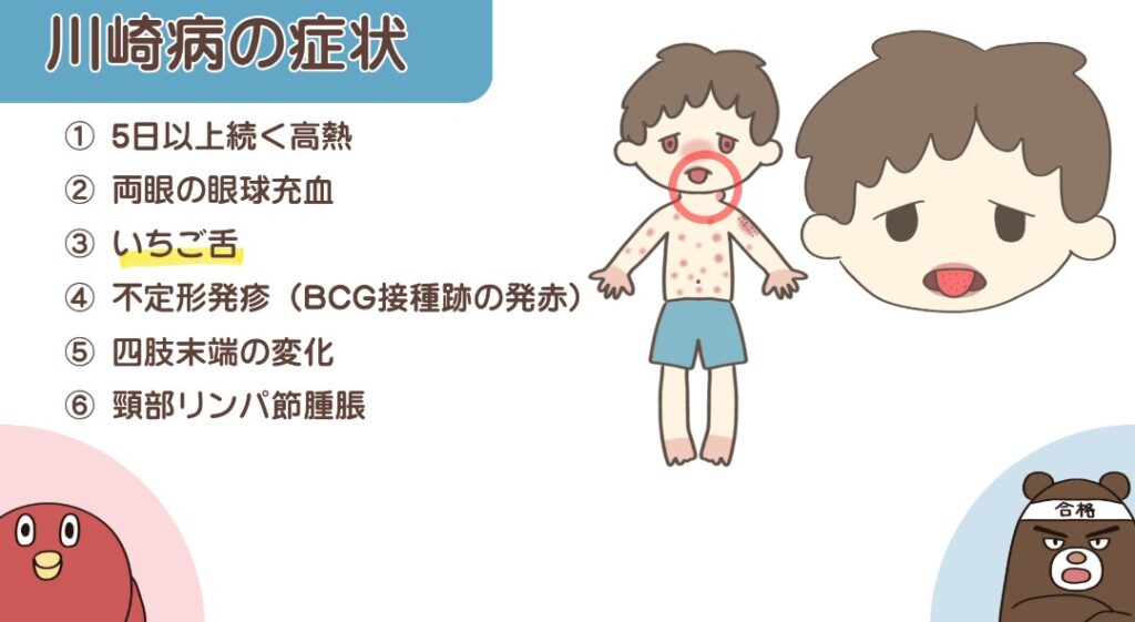 川崎病の症状(いちご舌)