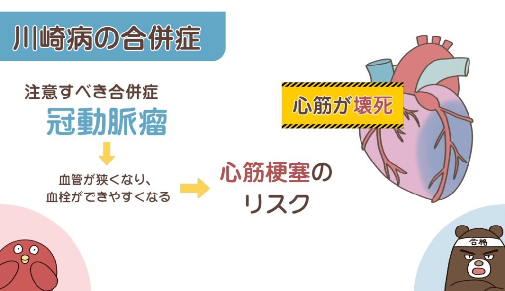 注意すべき川崎病の合併症(心筋梗塞、冠動脈瘤)