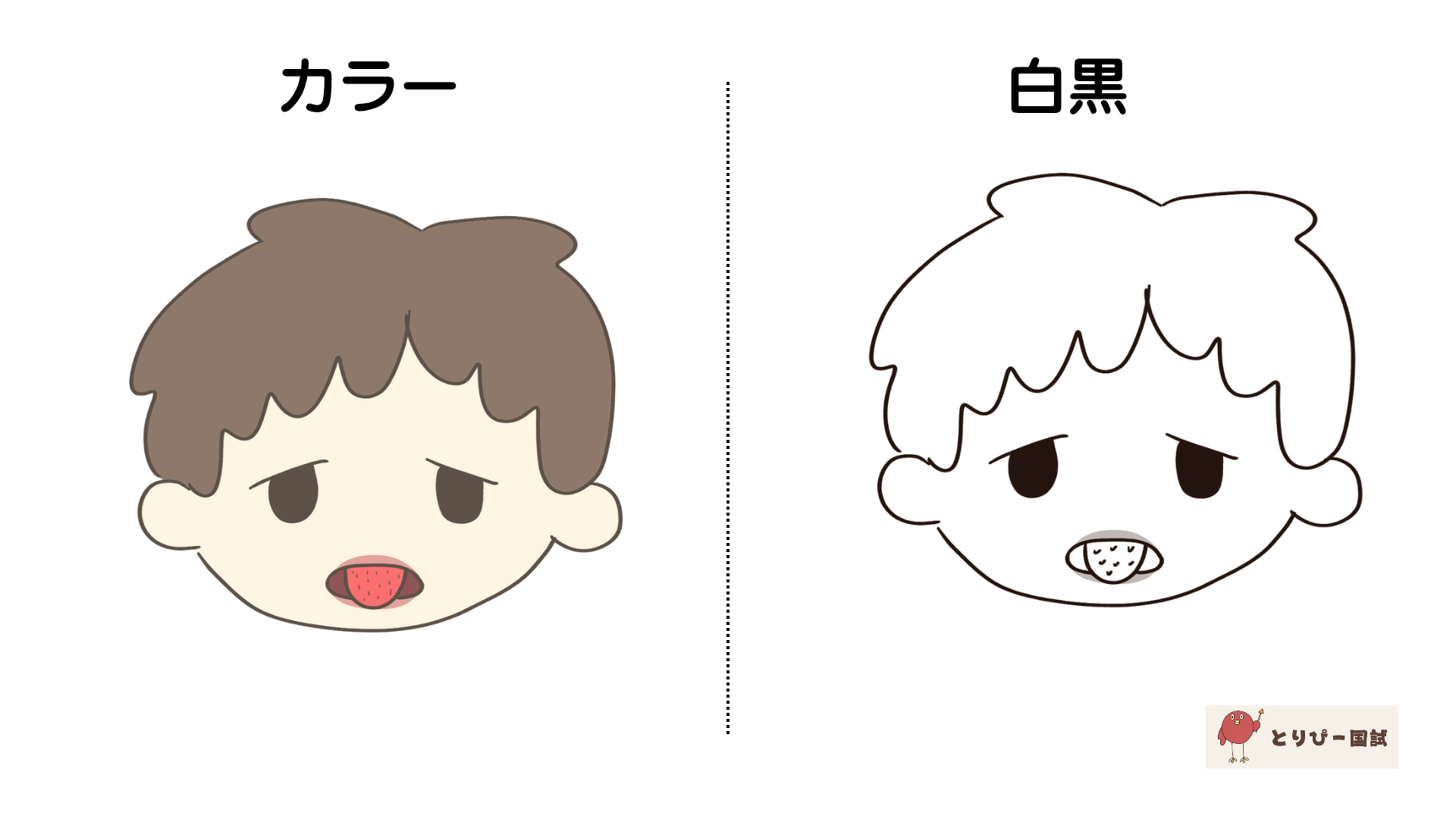 川崎病の症状いちご舌のフリーイラスト（カラーと白黒プレビュー）