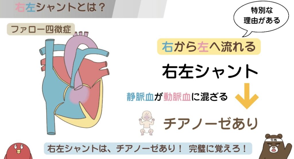 先天性心疾患の右左シャント（チアノーゼあり）をわかりやすく示した図解